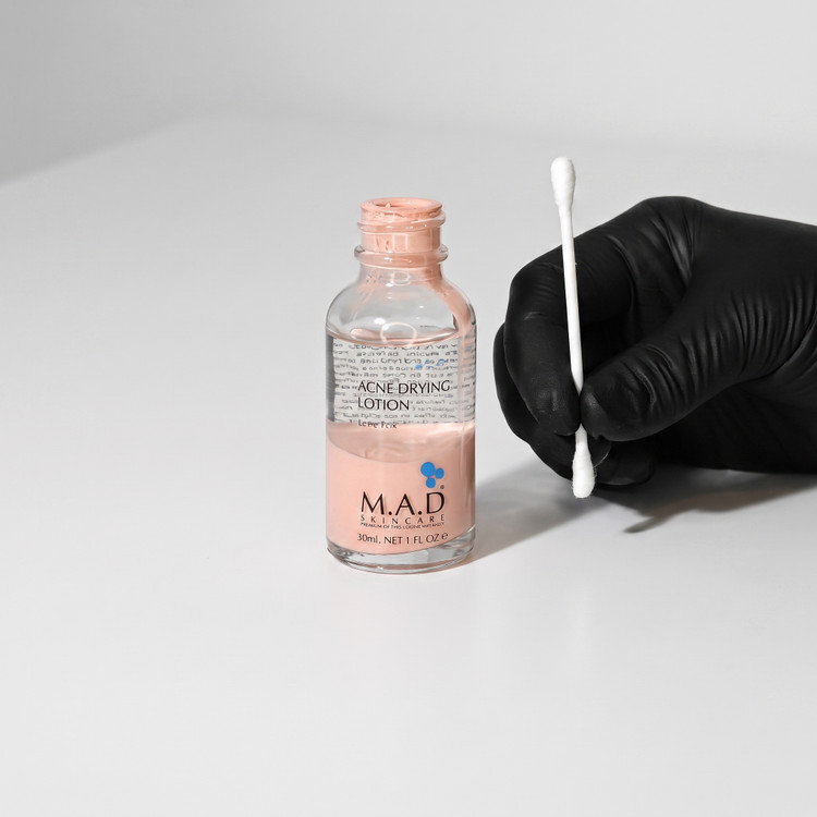 لوسیون ضد جوش ام ای دی M.A.D