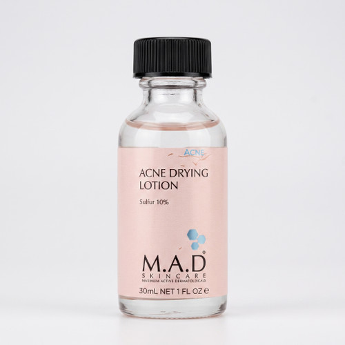 لوسیون ضد جوش ام ای دی M.A.D